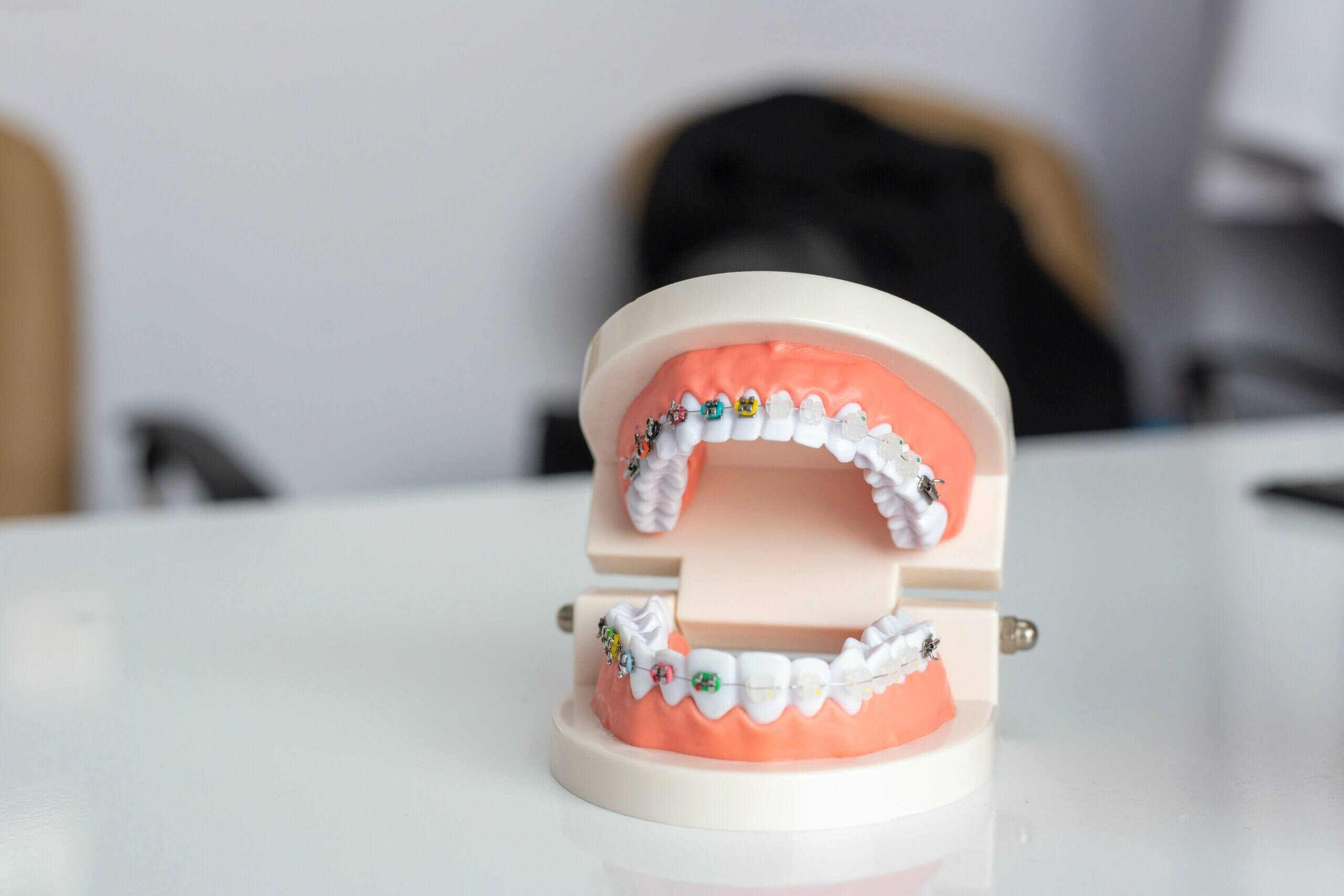 زيادة هائلة في عدد عمليات قلع الأسنان بسبب التسوس في بريطانيا