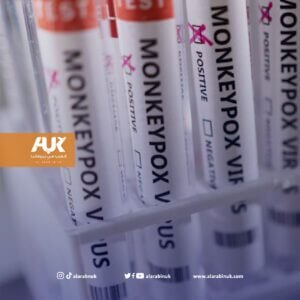 جدري القرود