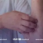 ارتفاع عدد إصابات الحصبة في بريطانيا بعد تراجع حملات التلقيح