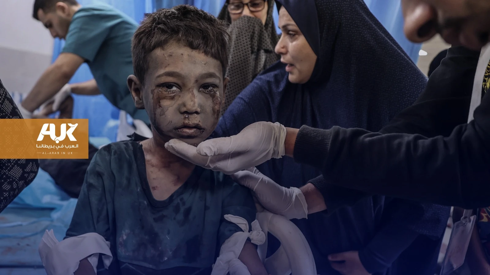 بريطانيا تتجاهل معاناة أطفال غزة المصابين بجروح خطيرة وترفض علاجهم