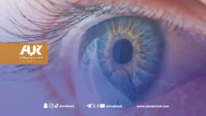 الموافقة على علاج جديد لسرطان العين النادر في بريطانيا