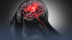 ارتفاع سكر الدم يدمر الدماغ.... إليك طرق الوقاية